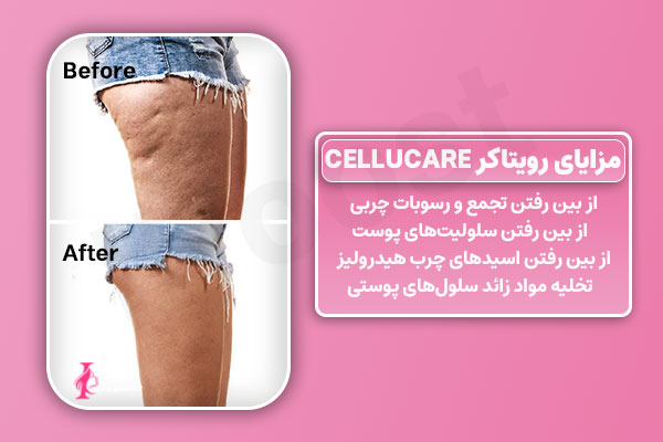 CYTOCARE Cellucare کوکتل سلوکر رویتاکر 