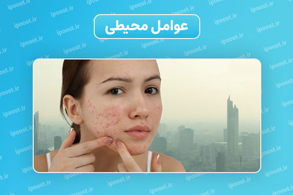 Environmental-factors عوامل محیطی بر روی پوست تاثیر گذارند