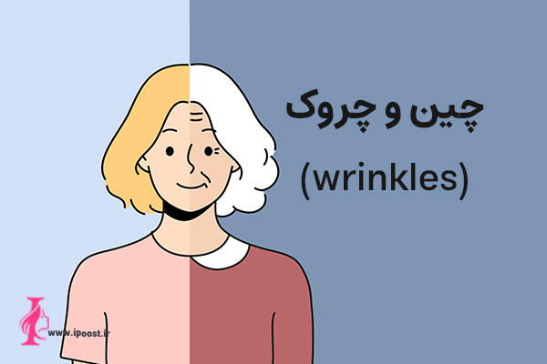 Remove-wrinkles چین و چروک
